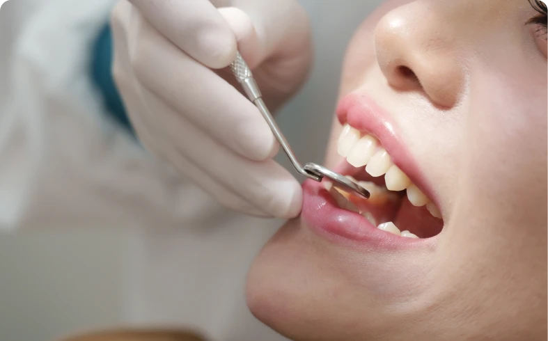 Dental check-up with mirror tool